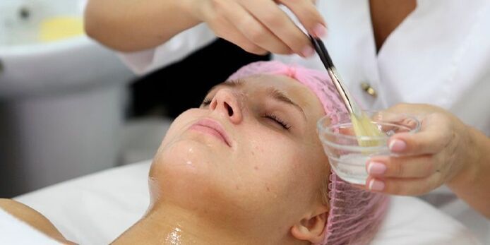 Një grua i nënshtrohet një procedure peeling